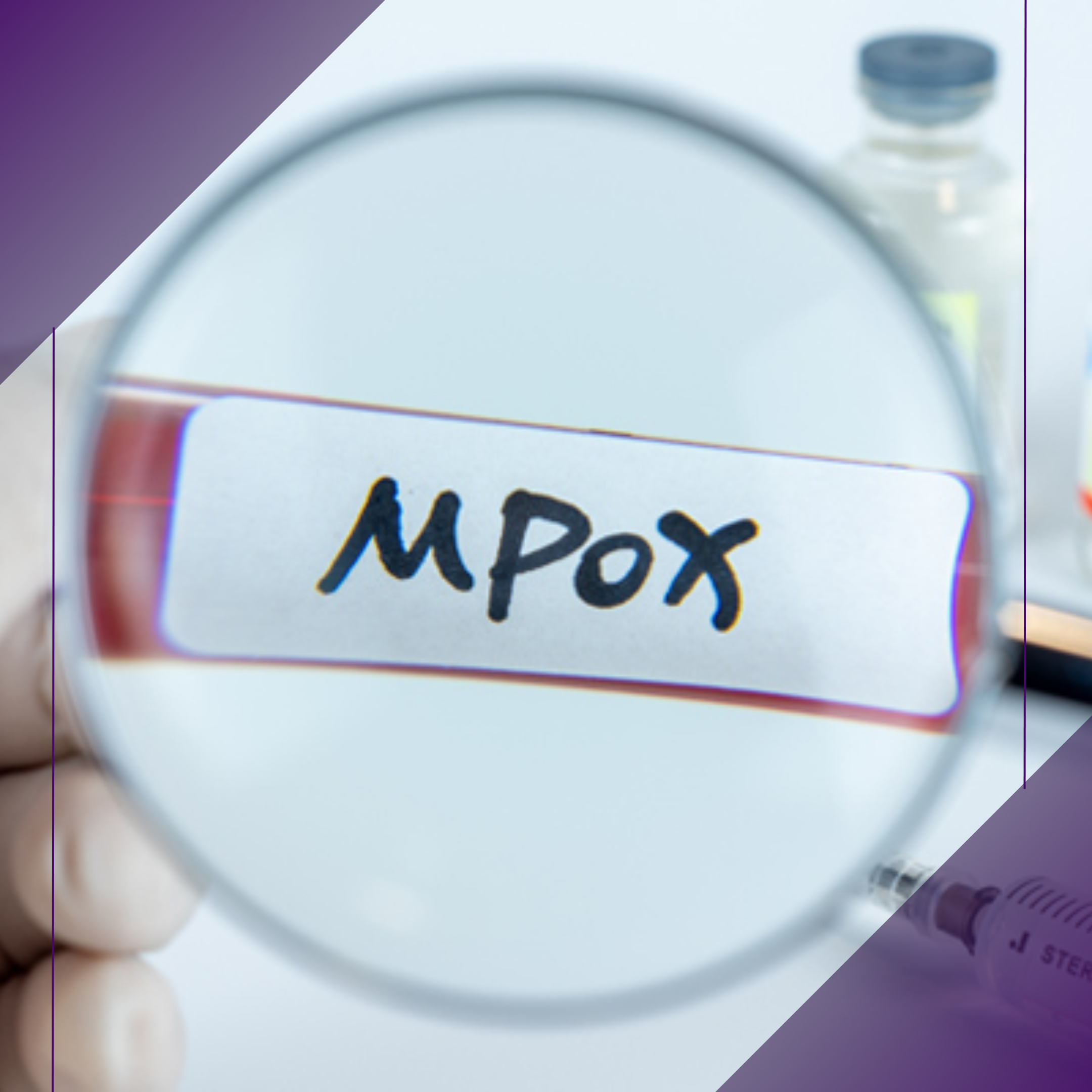 Le MPOX s’amplifie à Madagascar