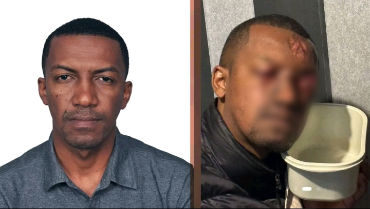 AMBOHITRIMANJAKA – Un agent d’escale agressé à l’acide sur la rocade